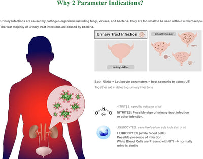 RhodesDavis Urinary Tract Infection Test Strips - 10 Individual Pouches, FSA Eligible UTI Urine Testing Kit for Leukocytes and Nitrite Detection (UTI-10P)